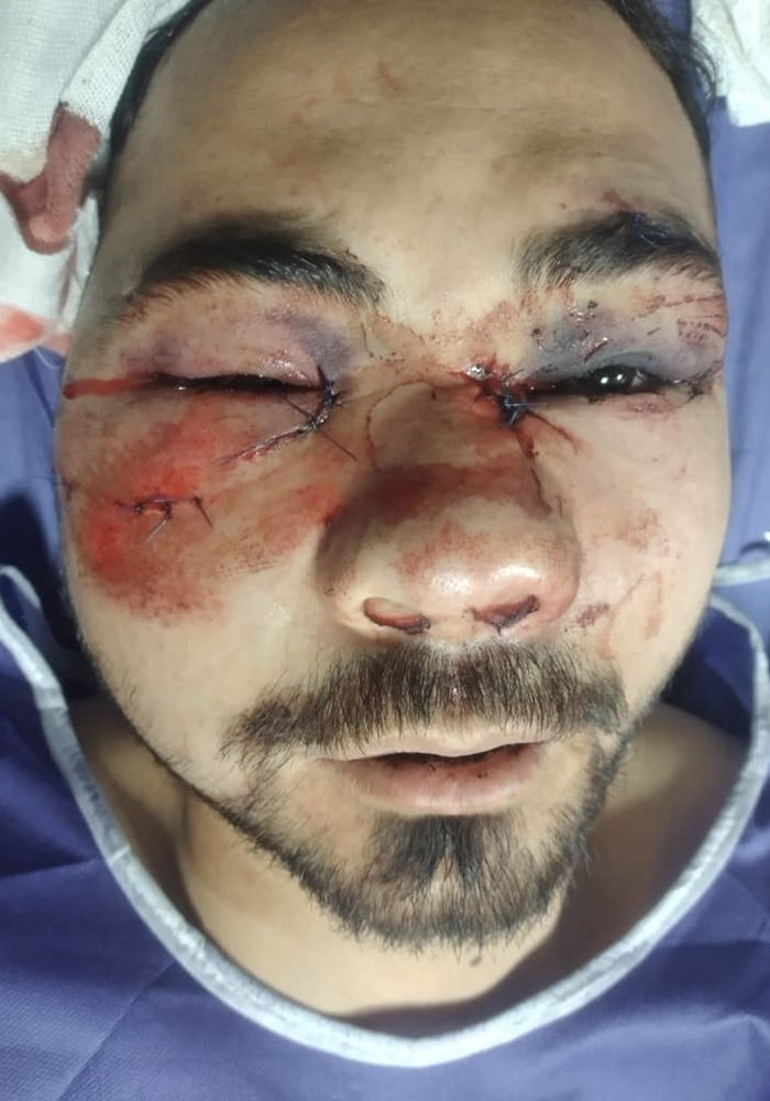 درمان شکستگی و آسیب‌های فک و صورت
