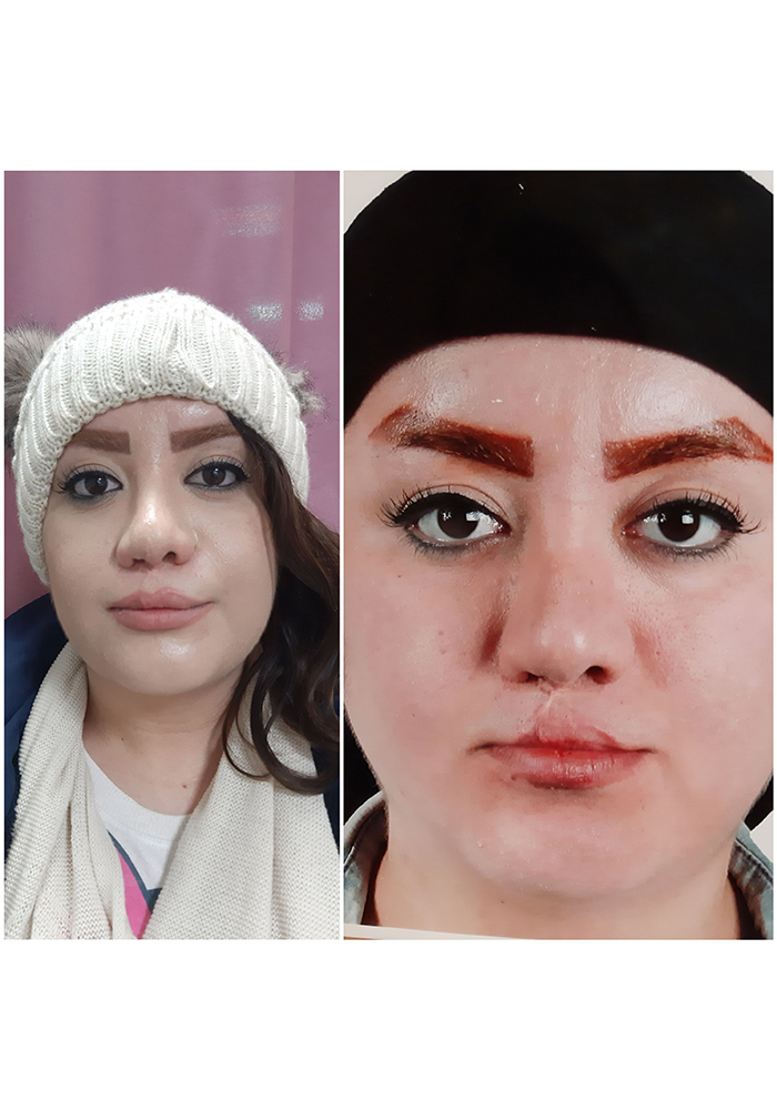 جراحی ارتوگناتیک
