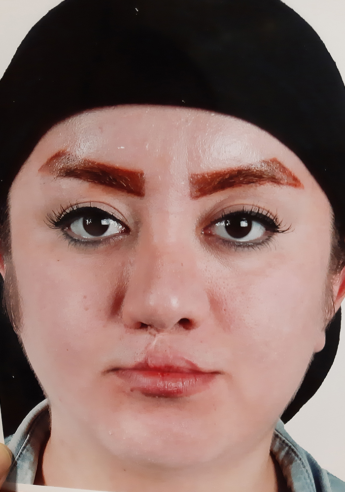 جراحی ارتوگناتیک