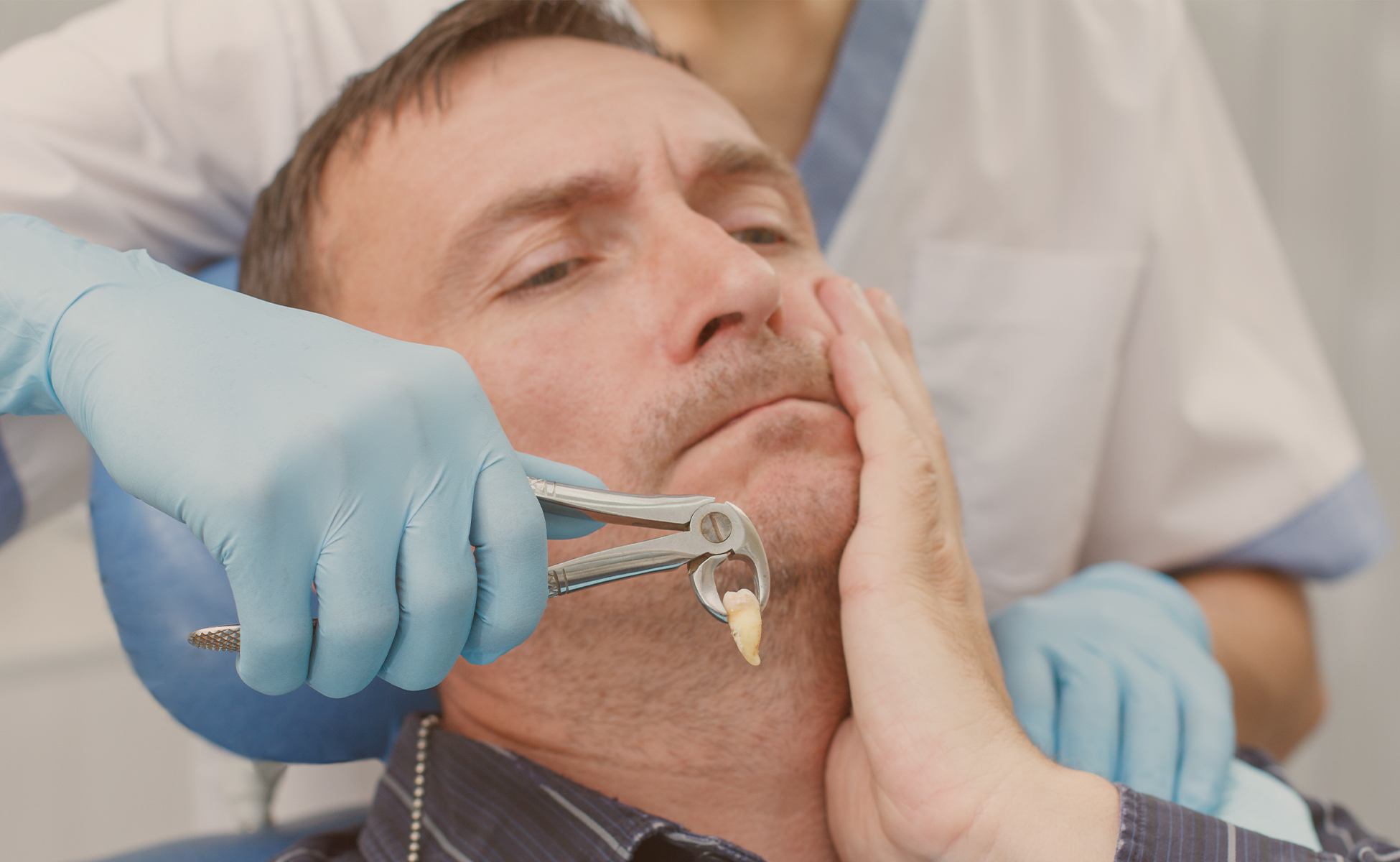 خروج دندان‌های نهفته (دندان عقل)